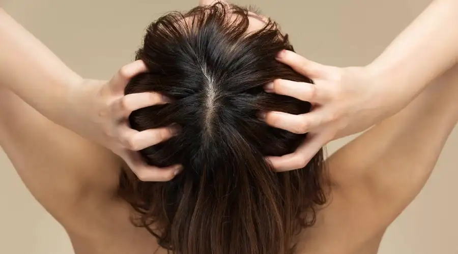 स्कैल्प की सही देखभाल